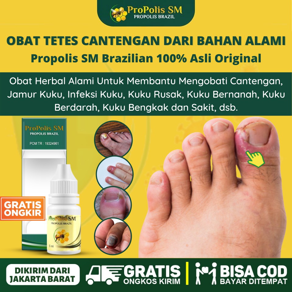 Solusi Obat Kuku Cantengan Infeksi Kuku Jamur Kuku Kuku Rusak Bengkak Bernanah Propolis Sm Shopee Indonesia