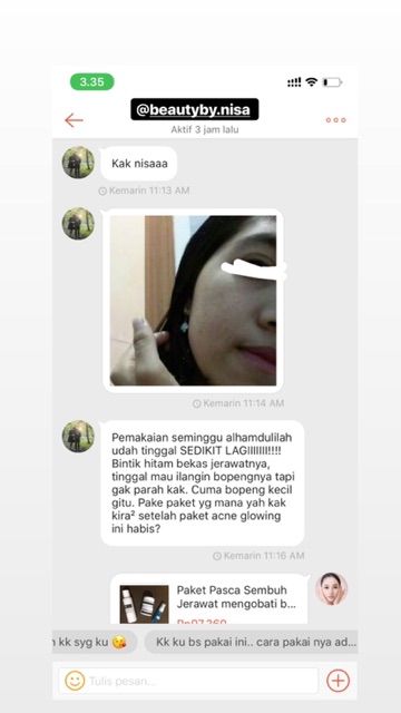 GLUTATHIONE CREAM KRIM SUPER WHITENING AMPUH KRIM DETOX WAJAH KRIM SUPER WHITE GLOWING PINK BPOM ORI ok