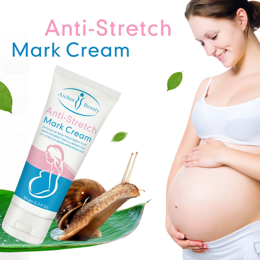 Anti Stretch Mark Cream AICHUN BEAUTY Stretch Mark Removal Bekas Luka Perbaikan Cream Stretch Mark Removal Perawatan Bekas Luka 60g body lotion, pelembab kulit, menghidrasi dan mengangkat