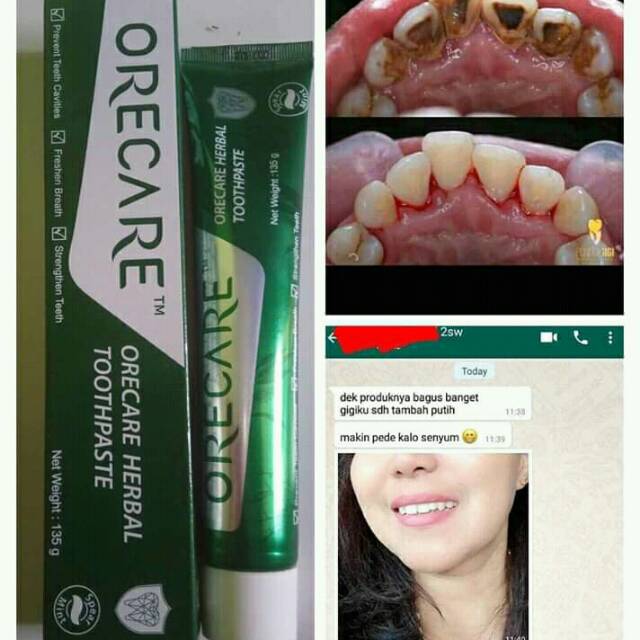 ODOL PEMUTIH GIGI
