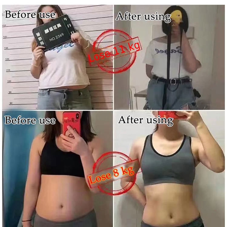 Pembakar Lemak menurunkan berat badan  Produk pelangsing roduk pelangsing badan 1box/10PCS Burn fat fast Belly Button Sticker Detox Magnet slimming stickers obat penurun berat badan wanita untuk pria