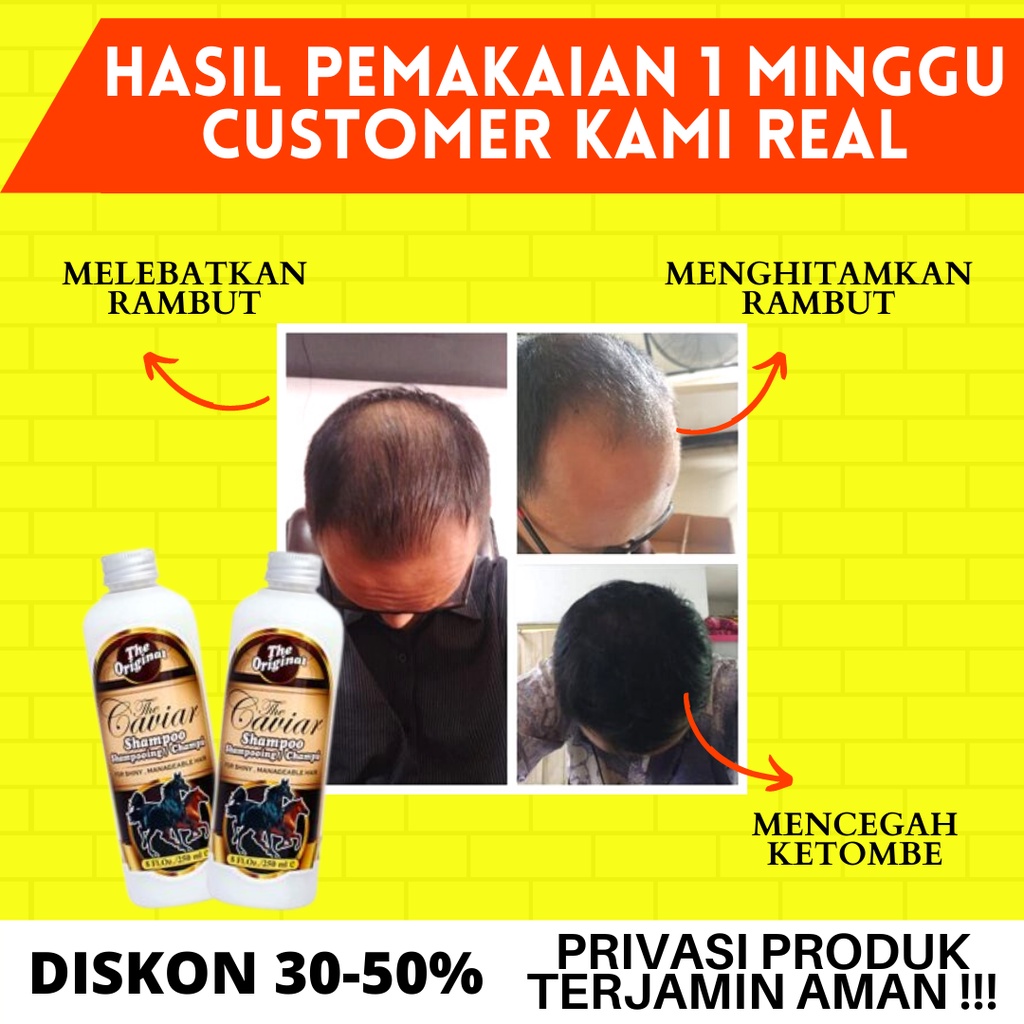 SHAMPOO PEMANJANG RAMBUT PENCEGAH RONTOK PENEBAL RAMBUT SHAMPOO CAVIAR 250ML ORIGINAL BPOM