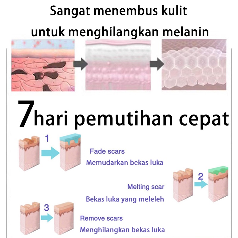 Krim Kehamilan StretchMark Cream krim bekas luka 30ml Pengencang Kulit Solusi Perut Gatal dan Anti Stretchmark Ibu Hamil Stretch Mark Krim Penghilang Stretch Mark mama choice stretch mark stretch mark