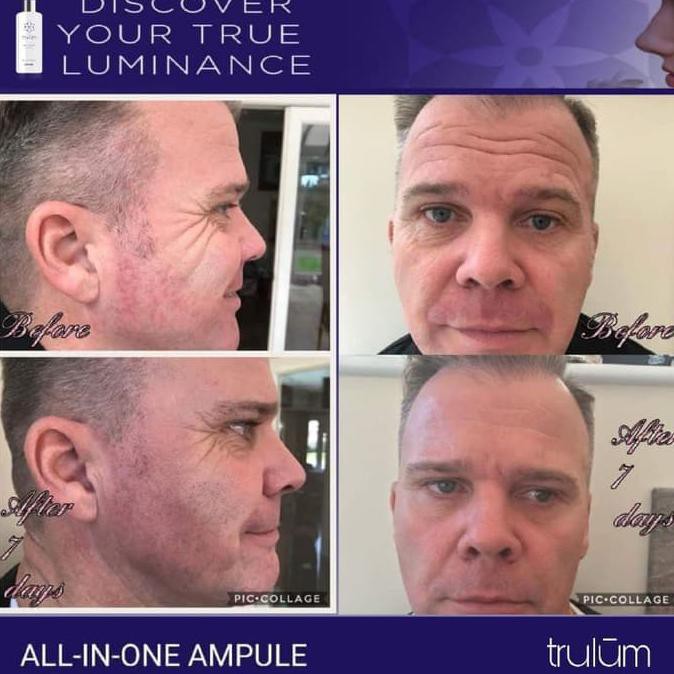 Krim Crem Pemutih Wajah Pria Wanita | Skincare Anti Aging Paling Ampuh