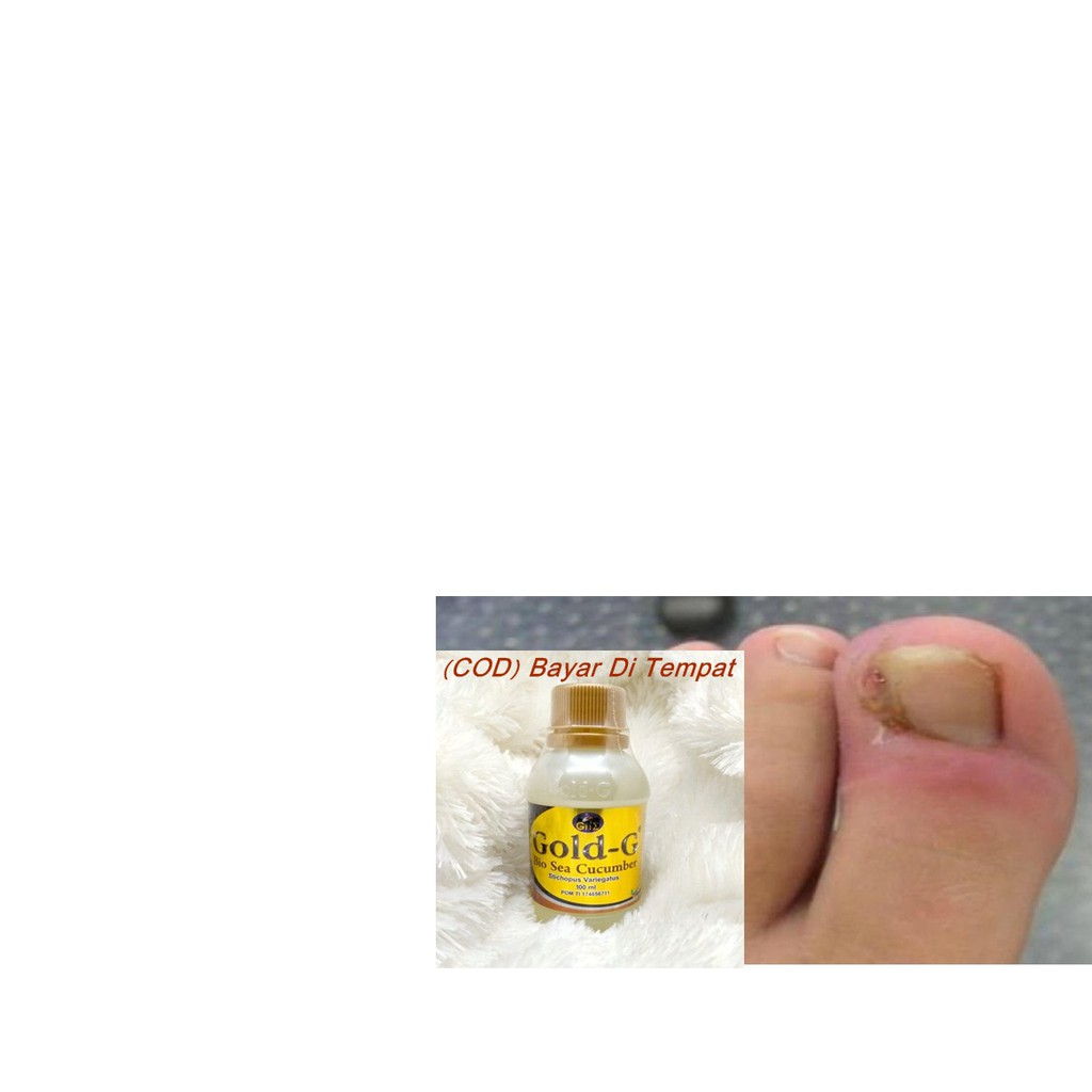 (PALING AMPUH) OBAT TETES MEMPERBAIKI KUKU RUSAK,KASAR AKIBAT CANTENGAN, JAMUR terbaru paling ampuh