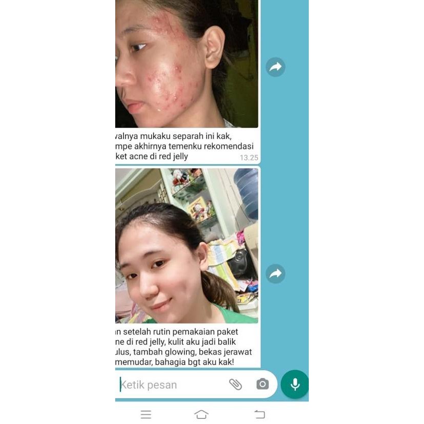 

SUPER MURAH - MSGLOW JUICE