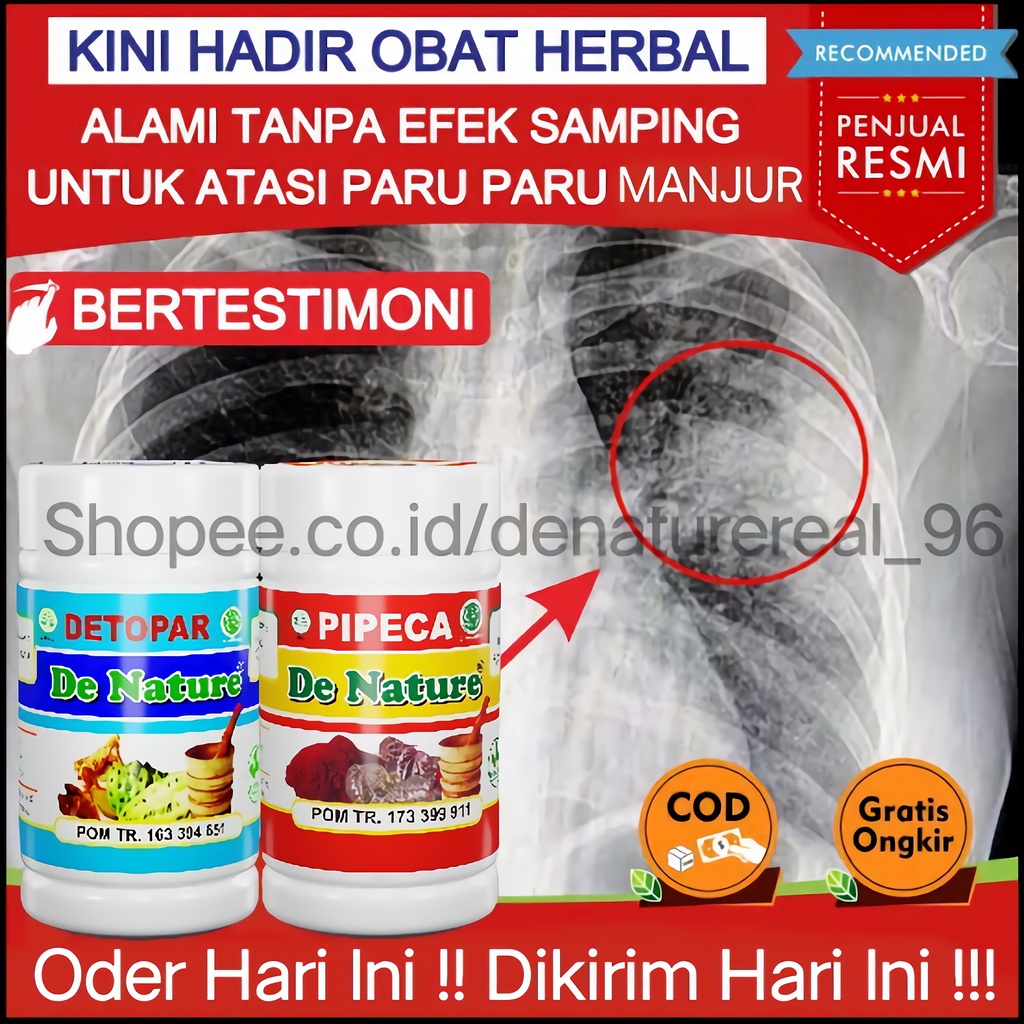 OBAT HERBAL PENYEMPITAN PARU-PARU,SESAK NAFAS, DADA NYERI, TBC, BATUK BERDAHAK, BATUK BERLENDIR,ALER