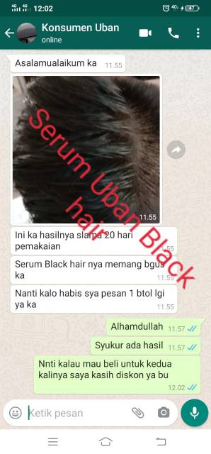 Jual Penghilang Uban Black Hair Serum, Tonic Dan Treatment | Shopee  Indonesia