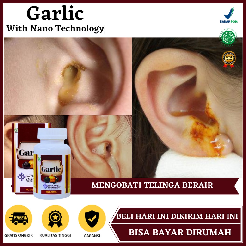 Obat Telinga Berair, Obat Telinga Berair dan Bau, Obat Telinga Berair Anak, Obat Telinga Berair Dewa