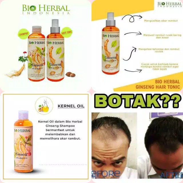 [ORI] PAKET SHAMPO + TONIC Penumbuh Rambut dan Obat Rontok dalam 1 Minggu l Bio Herbal Ginseng Asli