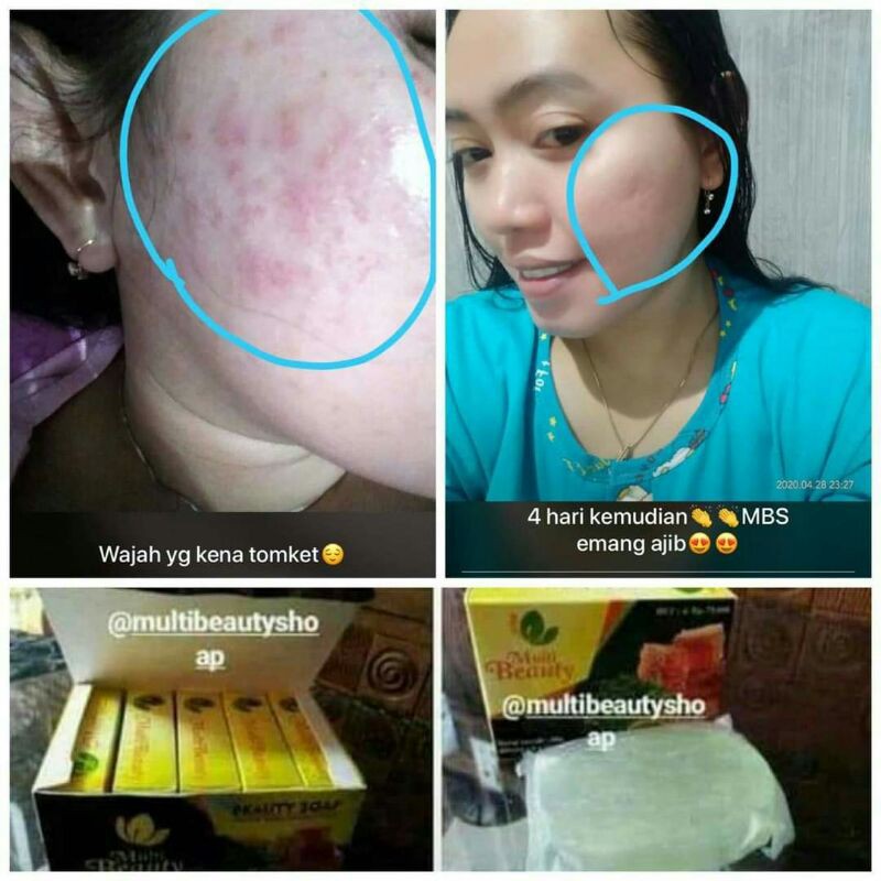 MBS (multi beauty skincare)COD bisa bayr di tempat