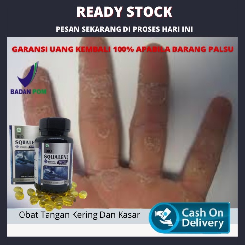 Obat Tangan Kering Dan Kasar, Obat Tangan Kering Dan Pecah, Obat Kulit Tangan Kering Pecah, Mengelup
