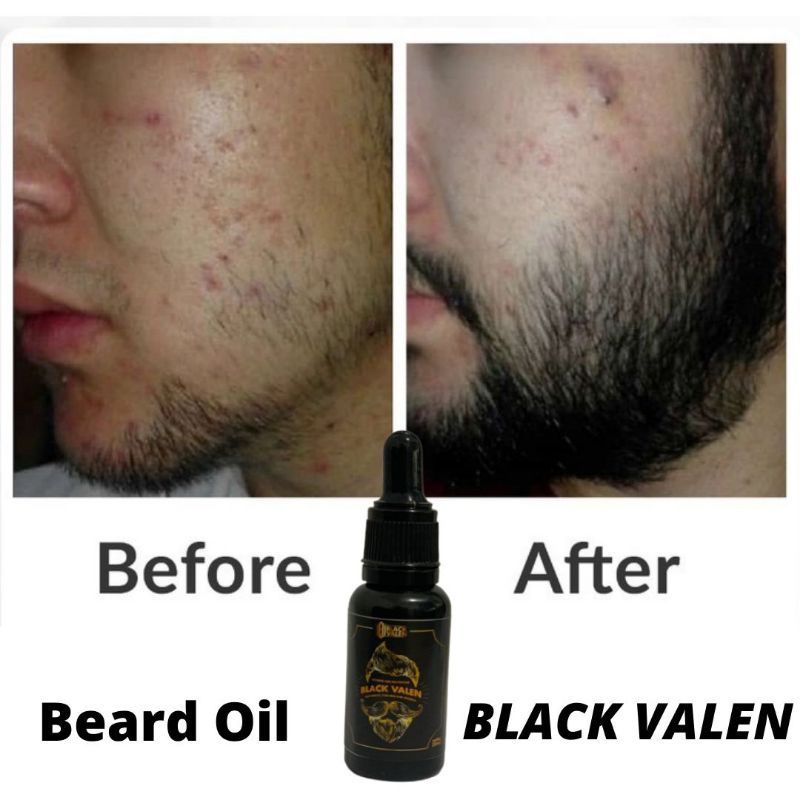 Beard Oil Black Valen Penumbuh Kumis Penumbuh Brewok Penumbuh Alis Jenggot