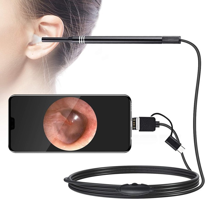 Visual Earwax Endoscope HD Clean Tool Pembersih Telinga Kamera