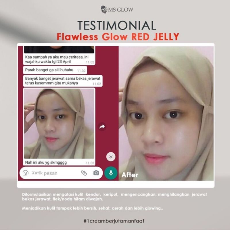 (Original 100%) Ms Glow Red Jelly / Red Jelly MS Glow Beauty