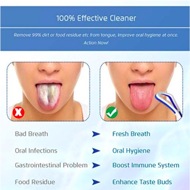 Tongue Cleaner Pembersih Lidah / Sikat Lidah Mengurangi Bau Mulut