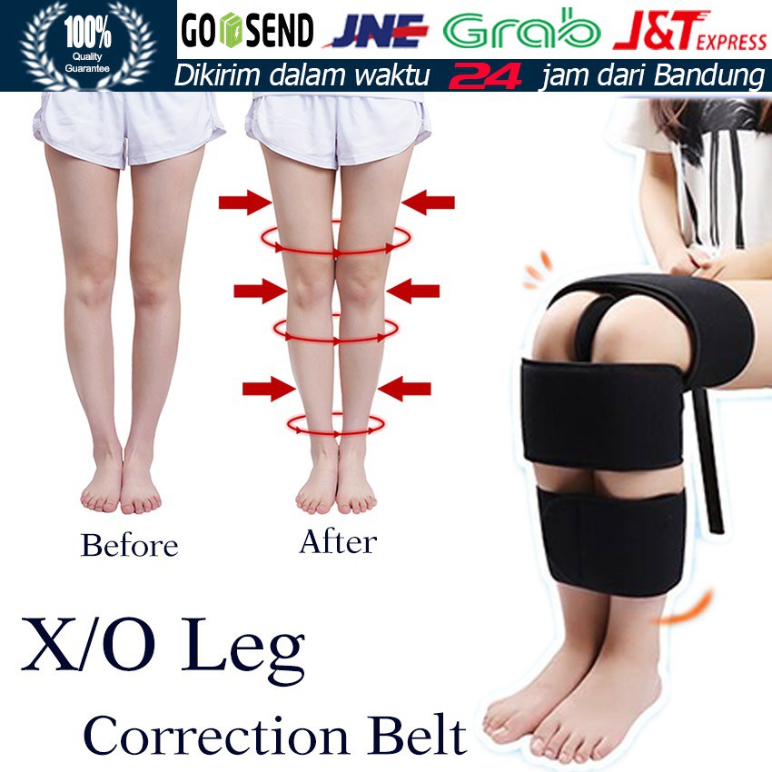 3Pcs O/X Legs Correction Braces Bandage Knock knee Bowlegs Orthotic