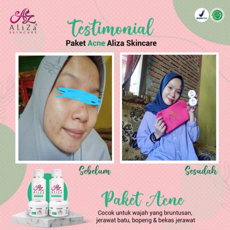 Aliza Skincare