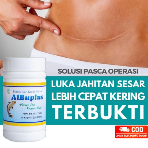 ALBUPLUS KAPSUL ALBUMIN EKSTRAK IKAN KUTUK GABUS ISI 60 KAPSUL ORIGINAL KHASIAT AMPUH