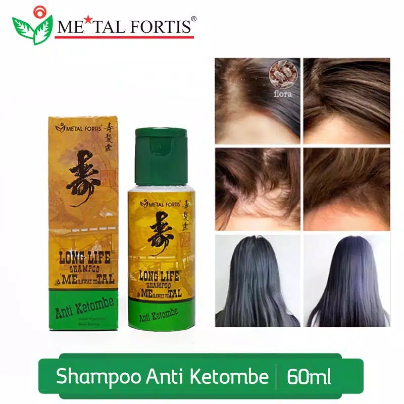 SHAMPOO METAL FORTIS KHUSUS ANTI KETOMBE RAMBUT CEPAT PANJANG