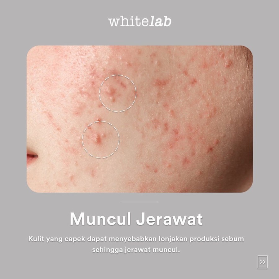 ★ BB ★ Whitelab Bamboo Charcoal Brightening Gel Mask - Masker Wajah