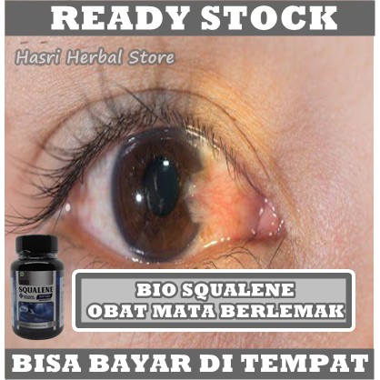 Obat Mata Berlemak, Pterygium, Mata Merah, Kering, Gatal, Perih Di Selaput - Bio Squalene Softgel