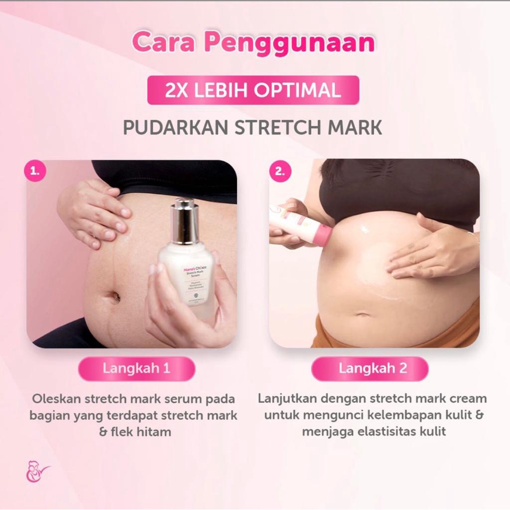 Mama's Choice Stretch Mark Cream Solusi Perut Gatal dan Stretch Mark