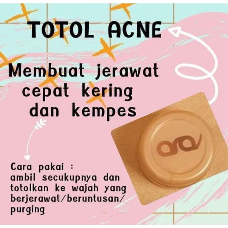 Totol Acne anzora/anzora acne/obat jerawat/totol jerawat/Krim jerawat/skincare anzora