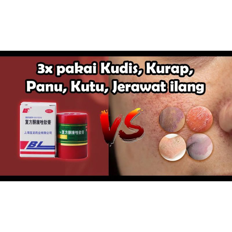 saleb BL original 100% asli salep gatal gatel selangkangan eksim kering paling manjur-2