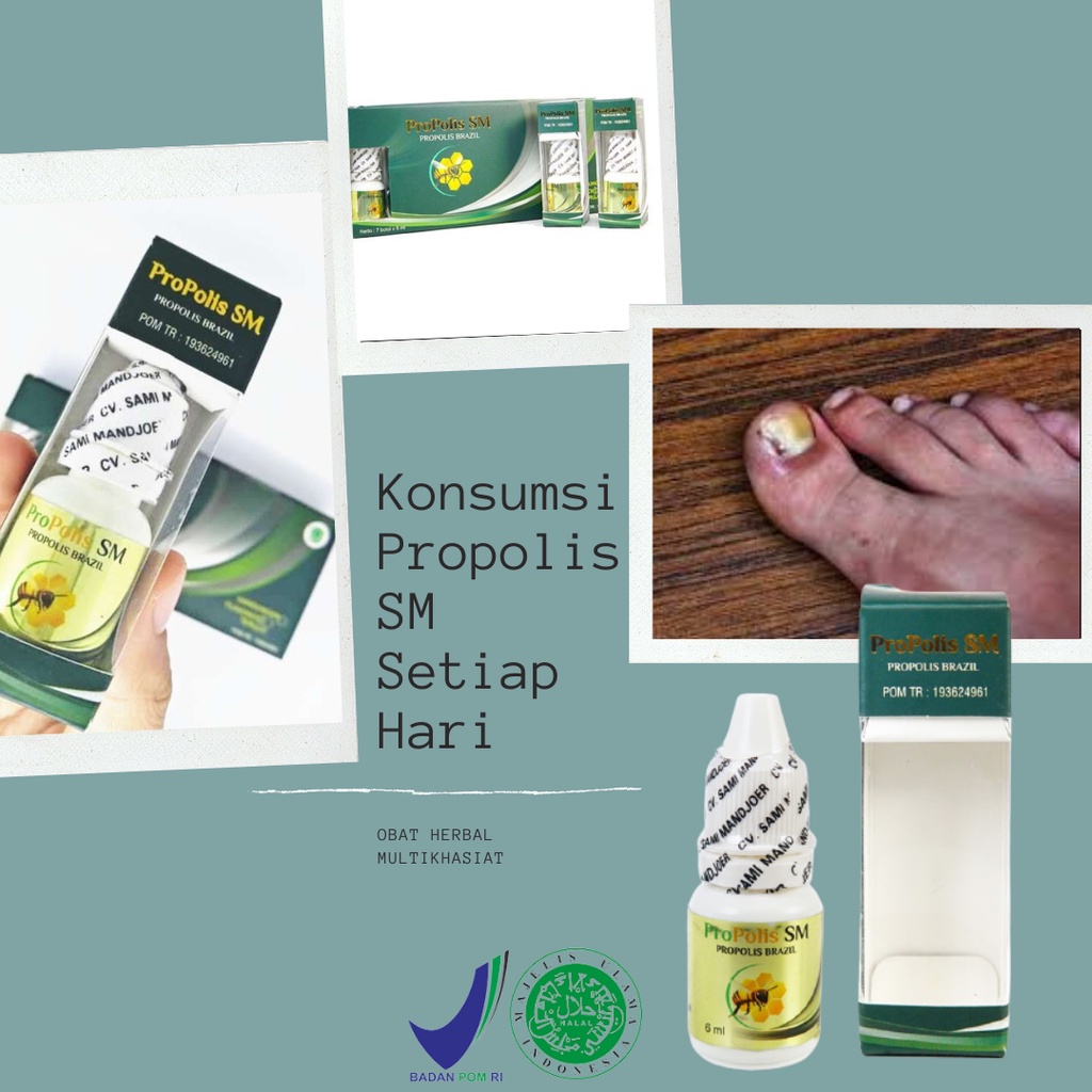 obat cantengan jempol kaki - obat jamur kuku - obat cantengan - obat kuku cantengan - obat kaki cant