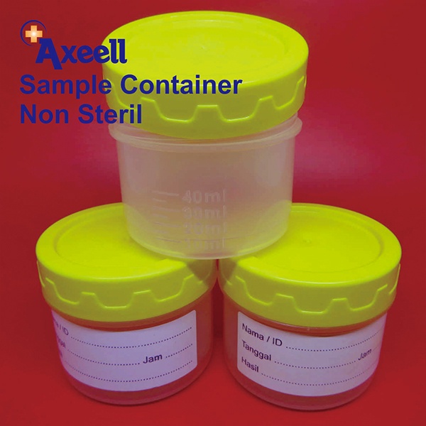 Jual Urine Container Non Steril Steril Pot Urine Wadah Sample Urine