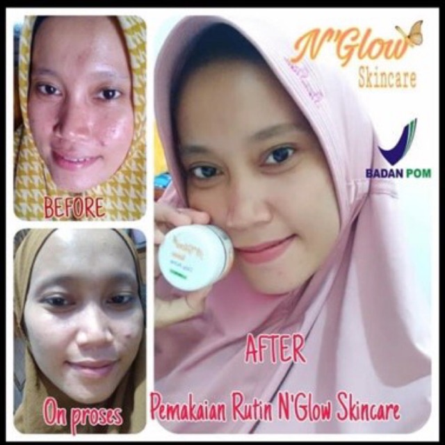 NGLOW SKINCARE ORIGINAL ORIGINAL BPOM!!(POUCH TERBARU)PROMO