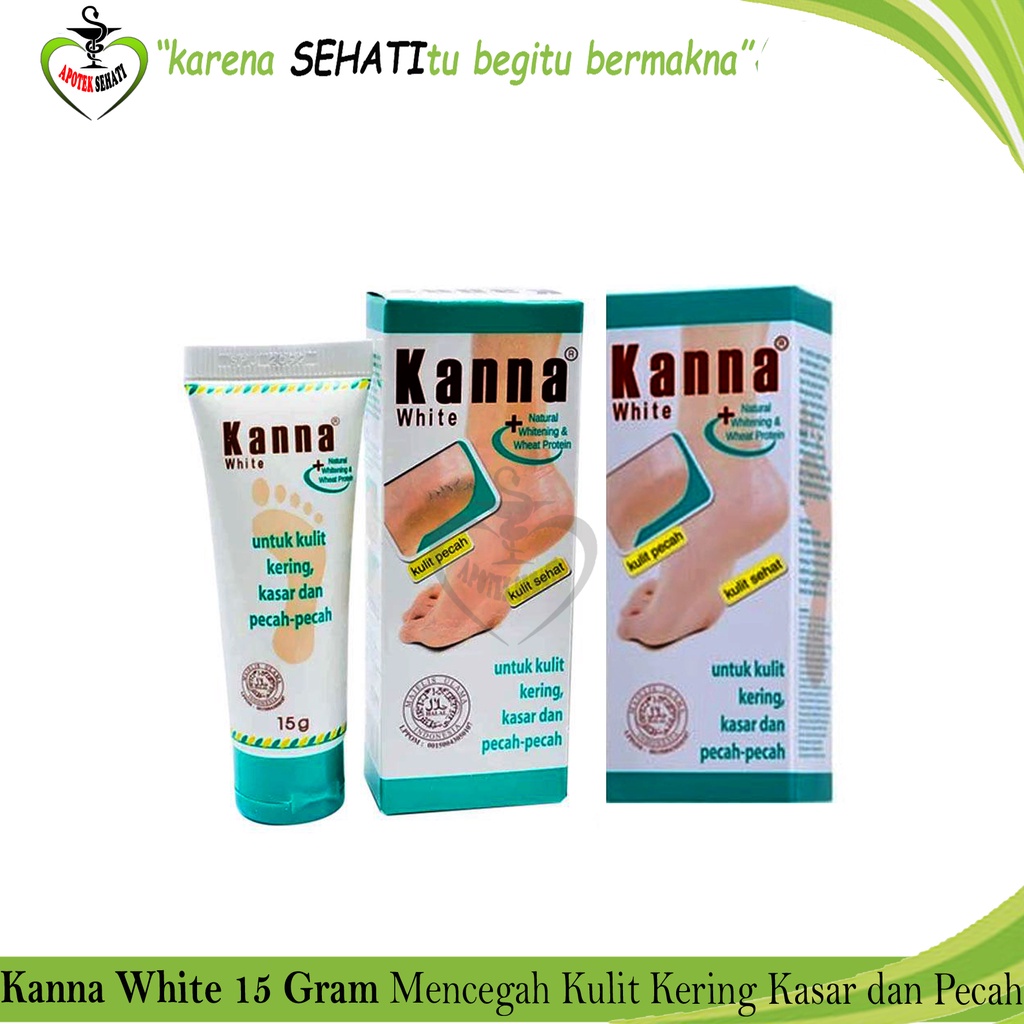 KANNA Soft Cream dan White Cream untuk Pelembab Kaki Pecah-Pecah Kanna Krim Kaki