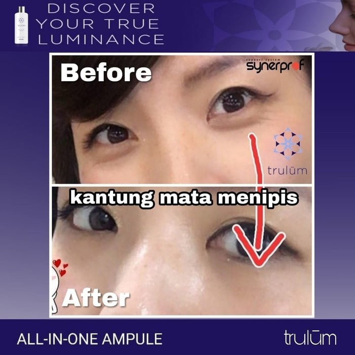 Trulum 5ml/15ml/120ml/Perawatan Kulit Wajah Keriput