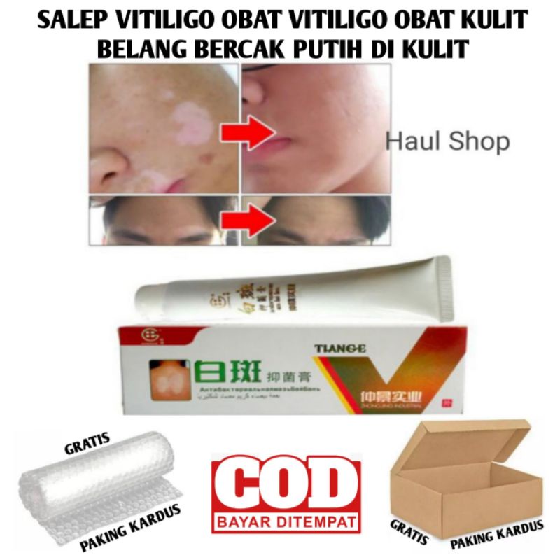 SALEP VITILIGO OBAT VITILIGO OBAT KULIT BELANG BERCAK PUTIH DI KULIT