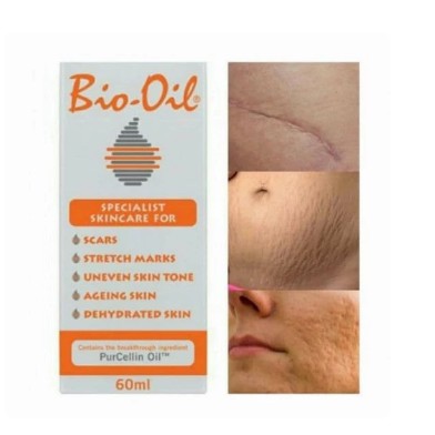 Bio Oil 60ml/ Penghilang Bekas Luka /Strech Mark/ Penghilang Jerawat