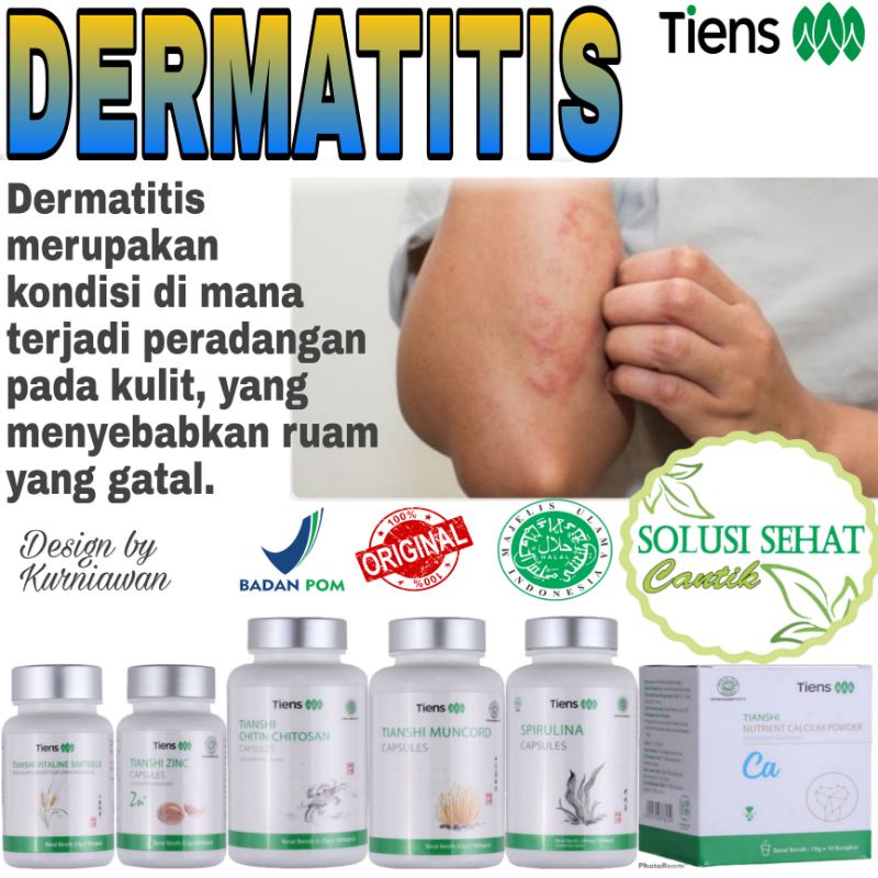 Paket Full Alergi Kulit Tiens / Tianshi / Herbal / Ori / Kalsium, Zinc, Spirulina, Muncord, Vitaline