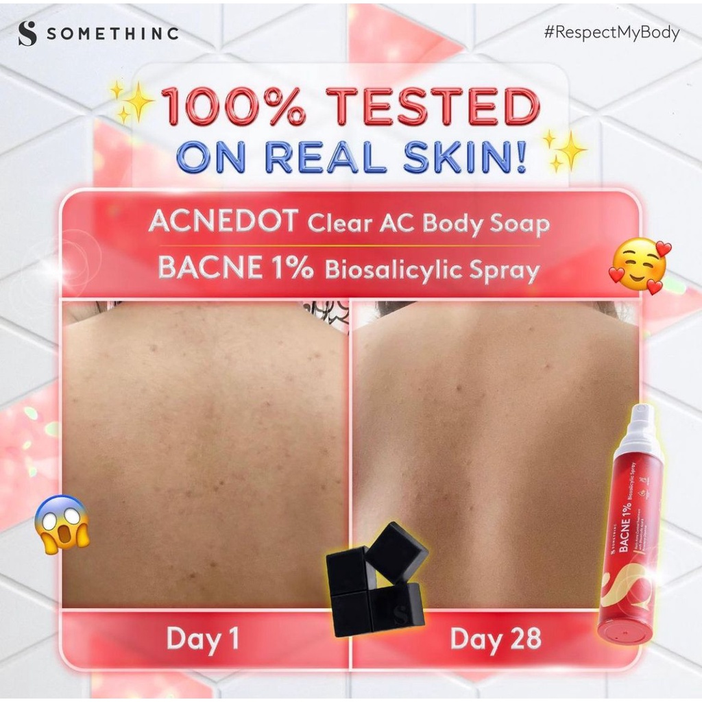 SOMETHINC Acnedot Clear AC Body Soap Punggung Kinclong Kit Sabun Badan Jerawat Biang Keringat