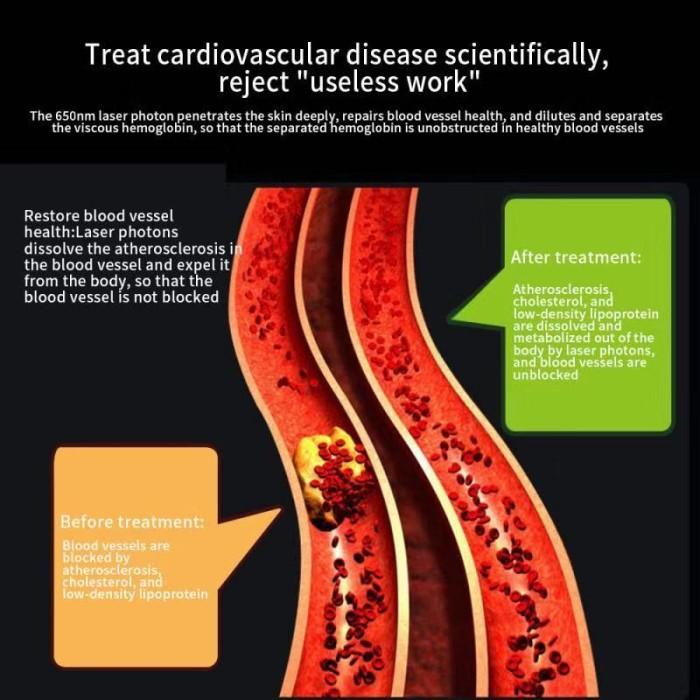 JAM TANGAN TERAPI LASER KESEHATAN 12 TITIK UNTUK DIABETES KOLESTEROL Best Seller