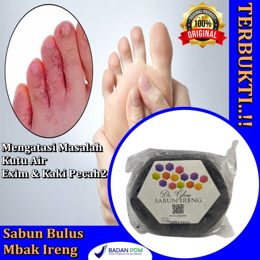 TERLARIS Obat Kutu Air dan Gatal disela Jari Kaki paling ampuh sabun mbak ireng dr glow ORI BPOM