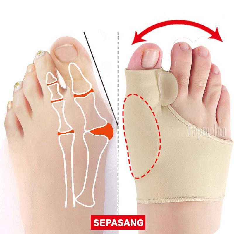 Alat Terapi Sleeve Korektor Tulang Jempol Bunion Bengkok Hallux Valgus Orthotics Sepasang