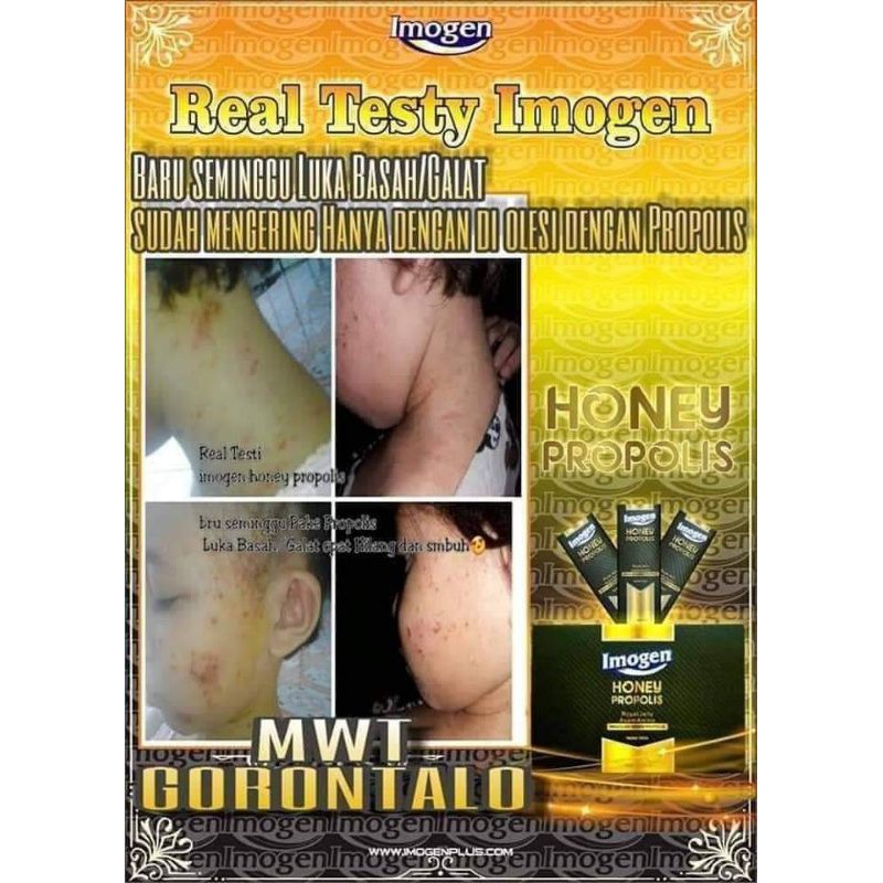 imogen honey propolis