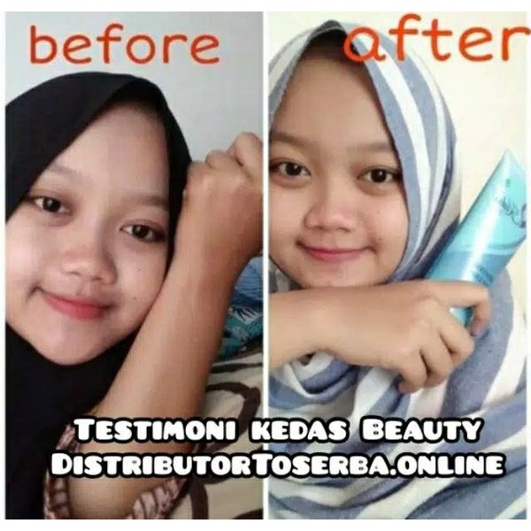 TERMURAH -  Paket kedas beauty original 100 perse  serum kedas beauty scrub kedas beauty Kedas