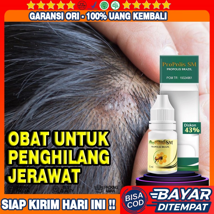 Obat Benjolan Bernanah Di Kepala, Obat Jerawat Kulit Kepala, Obat Tetes Benjolan Di Kepala, Propolis