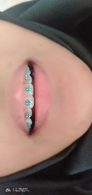 Bracket Amplop / Bracket Behel