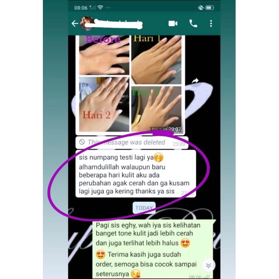 PELLING 200g DN BEAUTY WHITENING LOSION