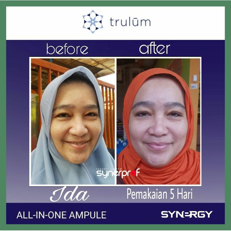 Skincare Herbal Alami Ampuh Obati flek hitam keriput & Bekas jerawat