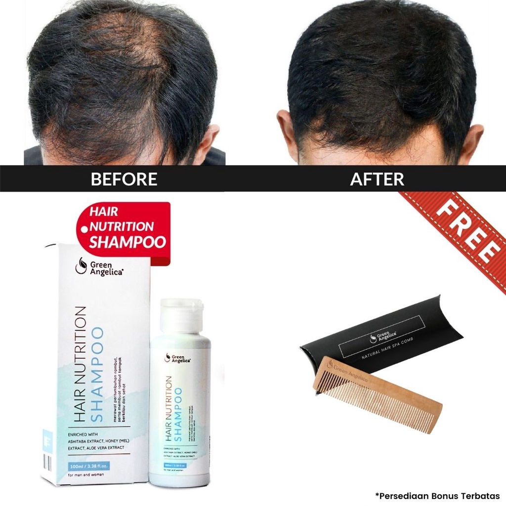 Shampoo Penumbuh Rambut - Herbal Cepat Solusi Rontok & Ketombe Ampuh Alami BPOM | Shampoo Penumbuh R
