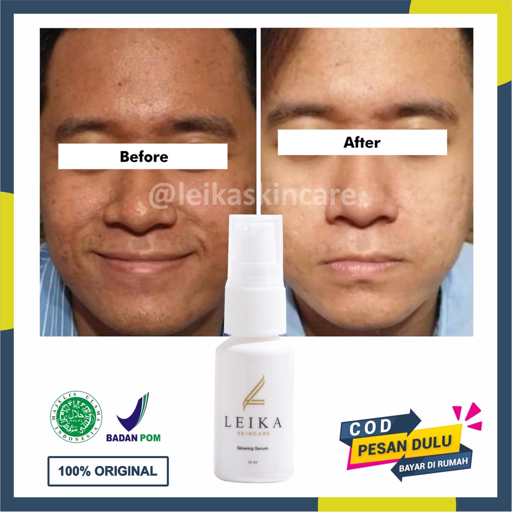 Serum Pencerah Wajah BPOM Aman Halal Serum Pencerah Kulit Wajah Hasil Permanen Serum Pencerah Wajah 