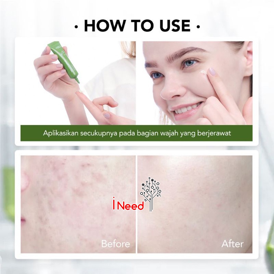 (INEED) YOU AcnePlus Triple Action Spot Care 15gr Gel Jerawat - Acne Spot Gel